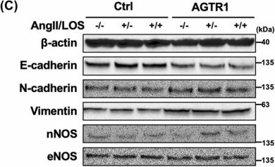 Fig.3.C showing Western Blotting from the publication: Angiotensin II type 1 receptor signaling promotes bladder cancer progression and its inhibition by Losartan.