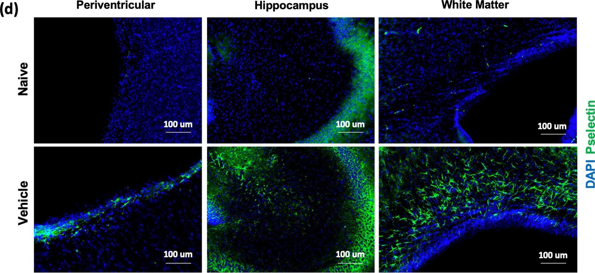 Fig.1.D showing Immunohistochemistry-immunofluorescence from the publication: A role for P-selectin and complement in the pathological sequelae of germinal matrix hemorrhage.