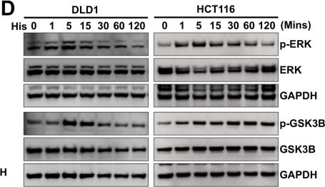 Fig.5.D showing Western Blotting in a Homo sapiens (Human) sample from the publication: Novel N-chloroacetyl-2-pyrazoline analogs with 2-naphthyl and ferrocenyl groups: targeting histamine receptor H1 to overcome colorectal cancer drug resistance.