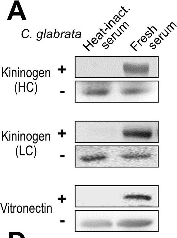 Fig.5.A showing Western Blotting in a Candida glabrata (Yeast) sample from the publication: Serum bridging molecules drive candidal invasion of human but not mouse endothelial cells.