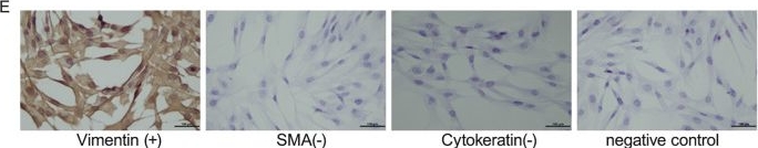 Fig.1.E showing Immunohistochemistry in a Homo sapiens (Human) sample from the publication: TGFB2-mediated regeneration of pelvic ligament equivalents using a stem cell-fibroblast-decellularized membrane composite.