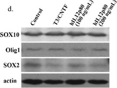 Fig.3.D showing Western Blotting in a Mus musculus (House mouse) sample from the publication: Human IL12p80 Promotes Murine Oligodendrocyte Differentiation to Repair Nerve Injury.