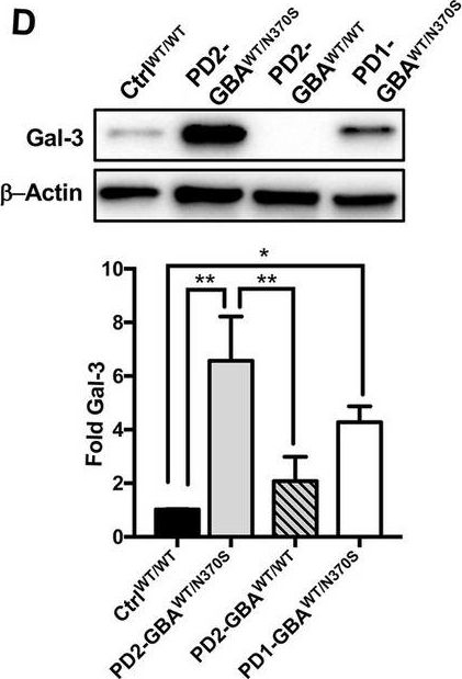 Fig.6.D showing Western Blotting in a Homo sapiens (Human) sample from the publication: Deregulation of mTORC1-TFEB axis in human iPSC model of GBA1-associated Parkinson's disease.