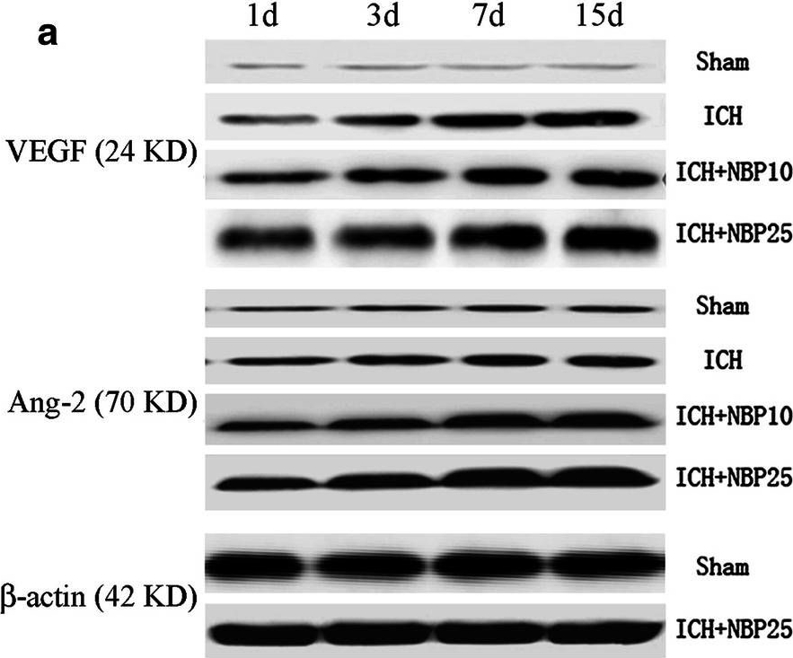 Fig.5.A showing Western Blotting in a Rattus norvegicus (Rat) sample from the publication: Dl-3-n-Butylphthalide promotes neovascularization and neurological recovery in a rat model of intracerebral hemorrhage.