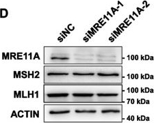 Fig.1.D showing Western Blotting in a Homo sapiens (Human) sample from the publication: MRE11A: a novel negative regulator of human DNA mismatch repair.