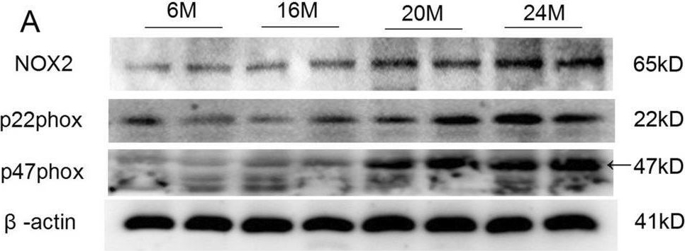 Fig.8.A showing Western Blotting in a Mus musculus (House mouse) sample from the publication: NLRP1 inflammasome involves in learning and memory impairments and neuronal damages during aging process in mice.