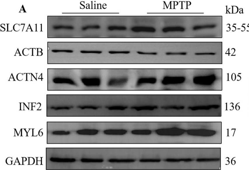 Fig.4.A showing Western Blotting from the publication: Disulfidptosis: A New Target for Parkinson's Disease and Cancer.