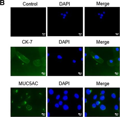 Fig.2.B showing Immunocytochemistry-immunofluorescence in a Homo sapiens (Human) sample from the publication: Human amniotic epithelial cell-derived exosomes promote conjunctival goblet cells proliferation and mucin secretion.