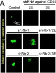 Fig.6.A showing Immunocytochemistry-immunofluorescence from the publication: Rb suppresses collective invasion, circulation and metastasis of breast cancer cells in CD44-dependent manner.