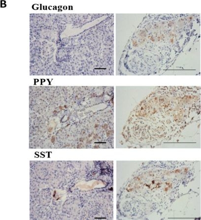 Fig.2.B showing Immunohistochemistry from the publication: A Protocol for the In Vitro Culturing of Vascularized Pancreatic Islet Organoids.