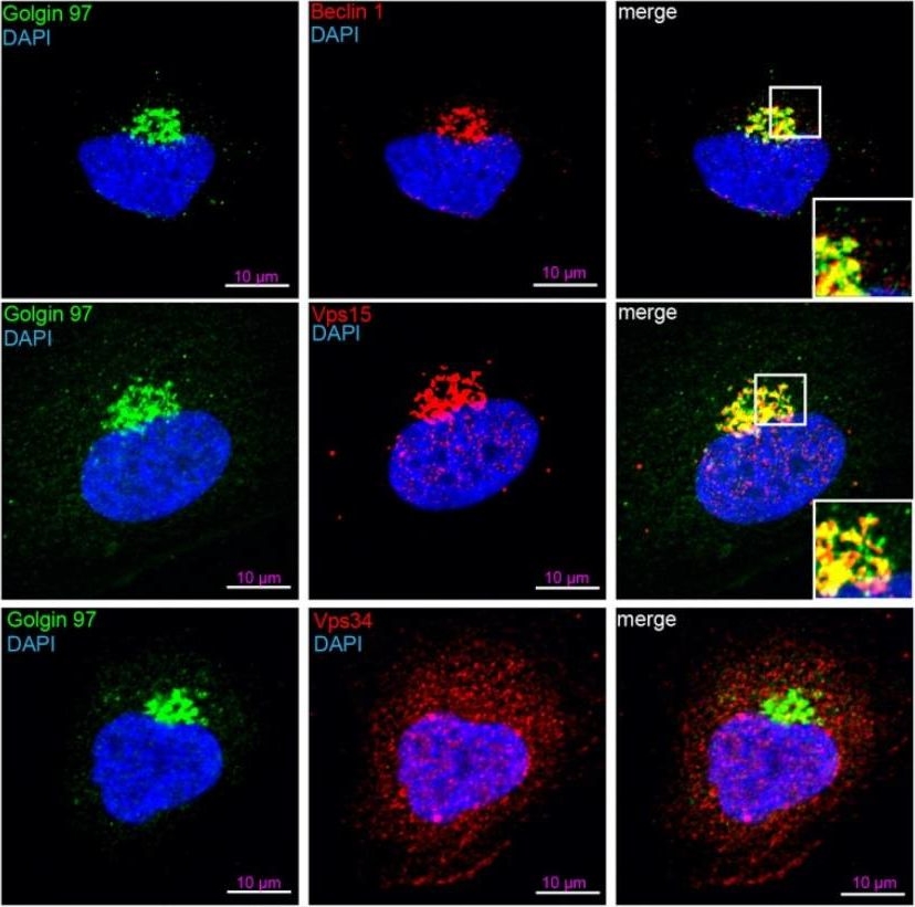 Fig.5.B showing Immunocytochemistry-immunofluorescence in a Homo sapiens (Human) sample from the publication: BECLIN1 Is Essential for Podocyte Secretory Pathways Mediating VEGF Secretion and Podocyte-Endothelial Crosstalk.