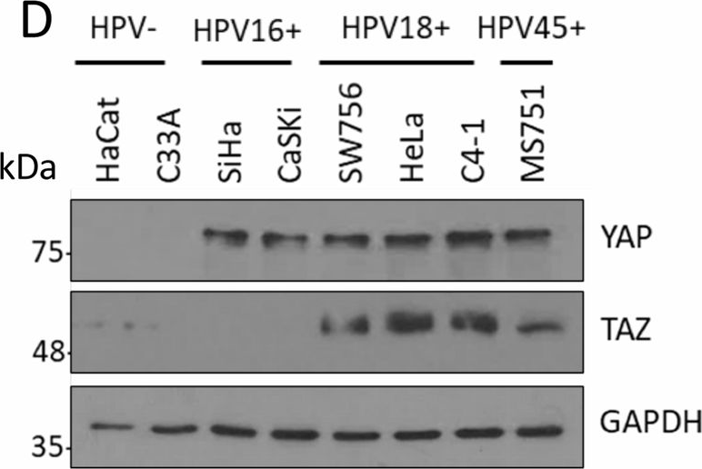 Fig.1.D showing Western Blotting in a Homo sapiens (Human) sample from the publication: The Hippo pathway transcription factors YAP and TAZ play HPV-type dependent roles in cervical cancer.