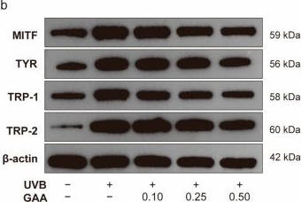 Fig.5.B showing Western Blotting from the publication: Ganoderic Acid A Reverses Ultraviolet B Induced Hyperpigmentation via Multi-Targeted Regulation of Mitochondrial Homeostasis and Inflammation.