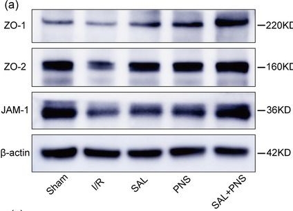 Fig.5.A showing Western Blotting in a Homo sapiens (Human) sample from the publication: Neuroprotective effects of salvianolic acids combined with Panax notoginseng saponins in cerebral ischemia/reperfusion rats concerning the neurovascular unit and trophic coupling.