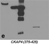 Fig.4.E showing Western Blotting in a Homo sapiens (Human) sample from the publication: Antiproliferative factor (APF) binds specifically to sites within the cytoskeleton-associated protein 4 (CKAP4) extracellular domain.