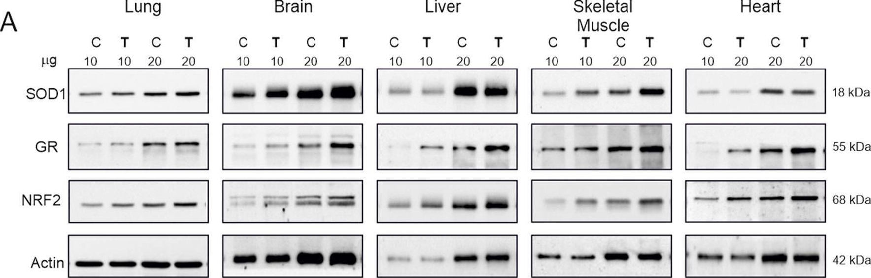 Fig.4.A showing Western Blotting in a Rattus norvegicus (Rat) sample from the publication: Impact of endurance training on mitochondrial H2O2 production and NRF2 levels in different rat organs.