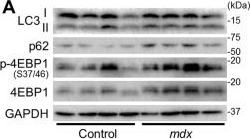 Resveratrol Ameliorates Mitophagy Disturbance and Improves Cardiac Pathophysiology of Dystrophin-deficient mdx Mice.