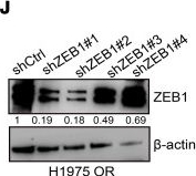 Fig.6.J showing Western Blotting in a Homo sapiens (Human) sample from the publication: Osimertinib activates a TGF-β2-dependent secretory program that drives lung adenocarcinoma progression.