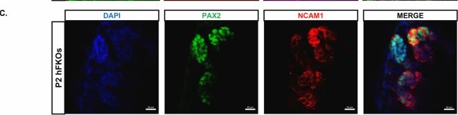 Fig.9.C showing Immunohistochemistry-immunofluorescence in a Homo sapiens (Human) sample from the publication: Human fetal kidney organoids model early human nephrogenesis and Notch-driven cell fate.