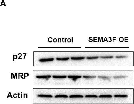 Fig.4.A showing Western Blotting from the publication: Semaphorin 3F induces colorectal cancer cell chemosensitivity by promoting P27 nuclear export.