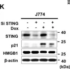 Fig.1.K showing Western Blotting from the publication: HMGB1 orchestrates STING-mediated senescence via TRIM30α modulation in cancer cells.