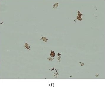 Fig.2.F showing Immunohistochemistry in a Bos taurus (Bovine) sample from the publication: Cells and Cytokines in Milk of Subclinically Infected Bovine Mammary Glands after the Use of Immunomodulatory Composition GLP 810.