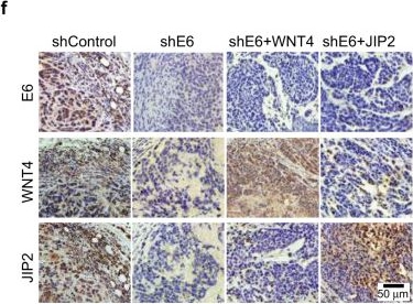 Fig.4.F showing Immunohistochemistry from the publication: E6-induced selective translation of WNT4 and JIP2 promotes the progression of cervical cancer via a noncanonical WNT signaling pathway.