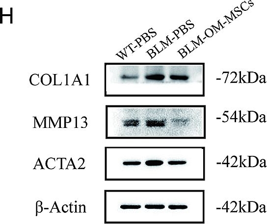 Fig.2.H showing Western Blotting from the publication: Olfactory mucosa mesenchymal stem cells alleviate pulmonary fibrosis via the immunomodulation and reduction of inflammation.