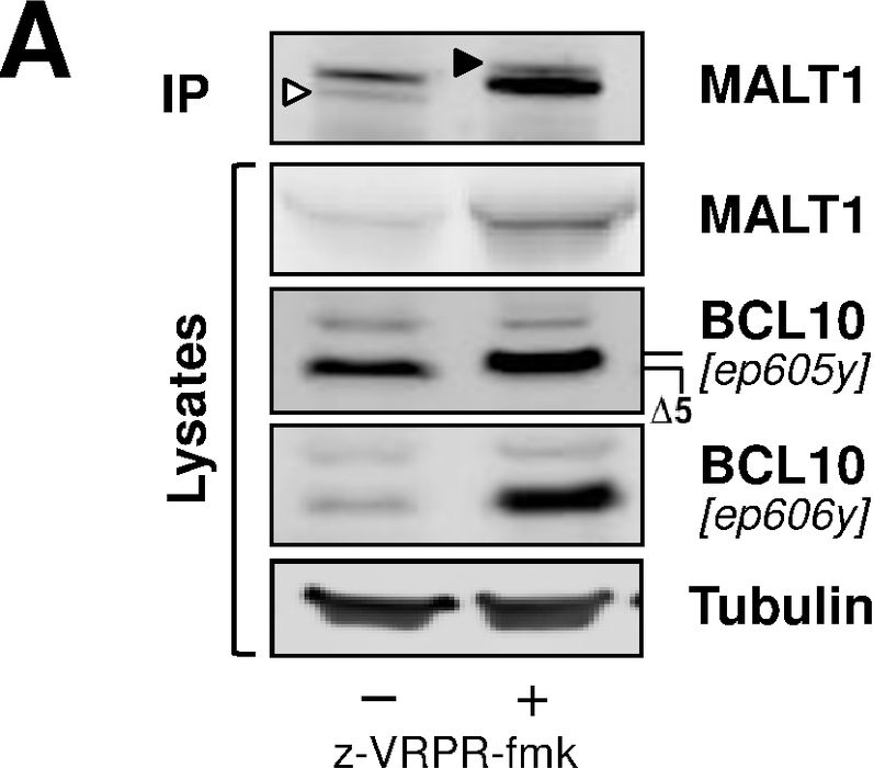 Fig.3.A showing Western Blotting in a Homo sapiens (Human) sample from the publication: Two Antagonistic MALT1 Auto-Cleavage Mechanisms Reveal a Role for TRAF6 to Unleash MALT1 Activation.
