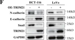 Fig.3.F showing Western Blotting from the publication: TRIM21-mediated PRMT1 degradation attenuates colorectal cancer malignant progression.