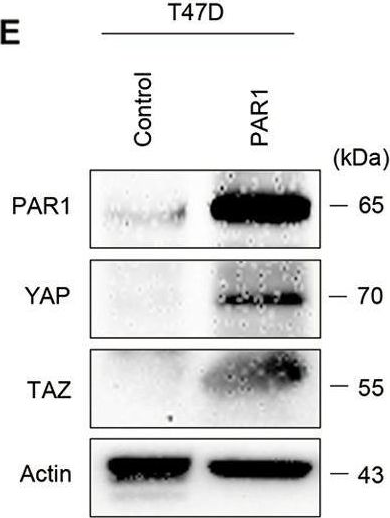 Fig.4.E showing Western Blotting from the publication: Twist-mediated PAR1 induction is required for breast cancer progression and metastasis by inhibiting Hippo pathway.