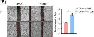 Fig.6.B from the publication: Tumour-derived SAA1 reprogrammes macrophages to promote CXCL1-mediated metastasis in Ovarian Cancer.