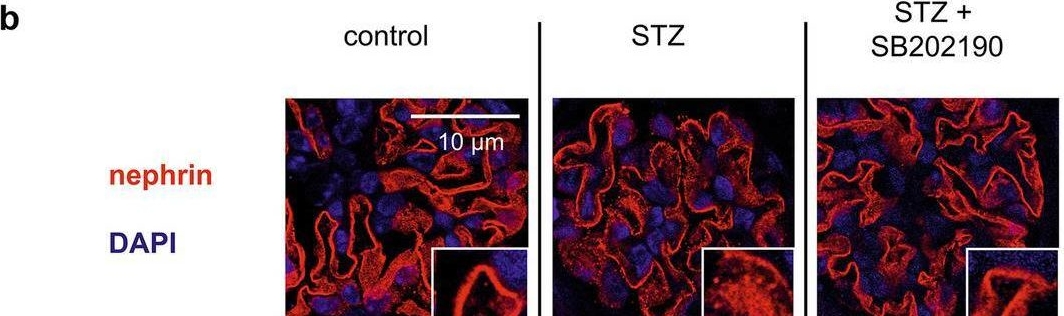Inhibition of p38 MAPK decreases hyperglycemia-induced nephrin endocytosis and attenuates albuminuria.