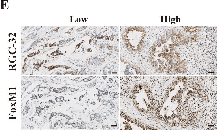 Fig.4.E showing Immunohistochemistry from the publication: Response Gene to Complement 32 promotes cell proliferation and tamoxifen resistance in breast cancer via elevated FoxM1 expression.