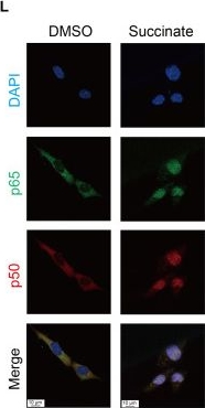 Fig.3.L showing Immunocytochemistry-immunofluorescence in a Mus musculus (House mouse) sample from the publication: NSUN2 Promotes Cancer Immune Evasion via Its Moonlighting Function Acting on Metabolic Reprogramming.