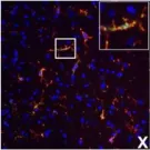 Fig.7.X showing Immunocytochemistry-immunofluorescence in a Mus musculus (House mouse) sample from the publication: IFN-gamma signaling in the central nervous system controls the course of experimental autoimmune encephalomyelitis independently of the localization and composition of inflammatory foci.