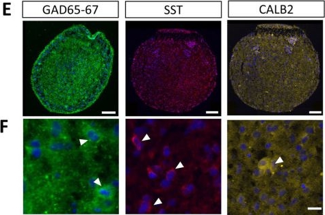 Fig.3.E showing Immunohistochemistry-immunofluorescence from the publication: Neurosteroid withdrawal disrupts GABAergic system development in human cortical organoids: implications for preterm birth.