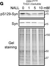 Fig.1.G showing Western Blotting in a Homo sapiens (Human) sample from the publication: N-acetyl-l-leucine lowers α-synuclein levels and improves synaptic function in Parkinson's disease models.