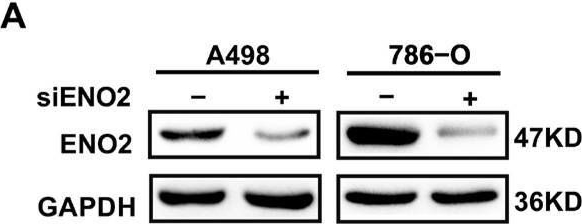 Fig.5.A showing Western Blotting in a Homo sapiens (Human) sample from the publication: ENO2 as a Biomarker Regulating Energy Metabolism to Promote Tumor Progression in Clear Cell Renal Cell Carcinoma.