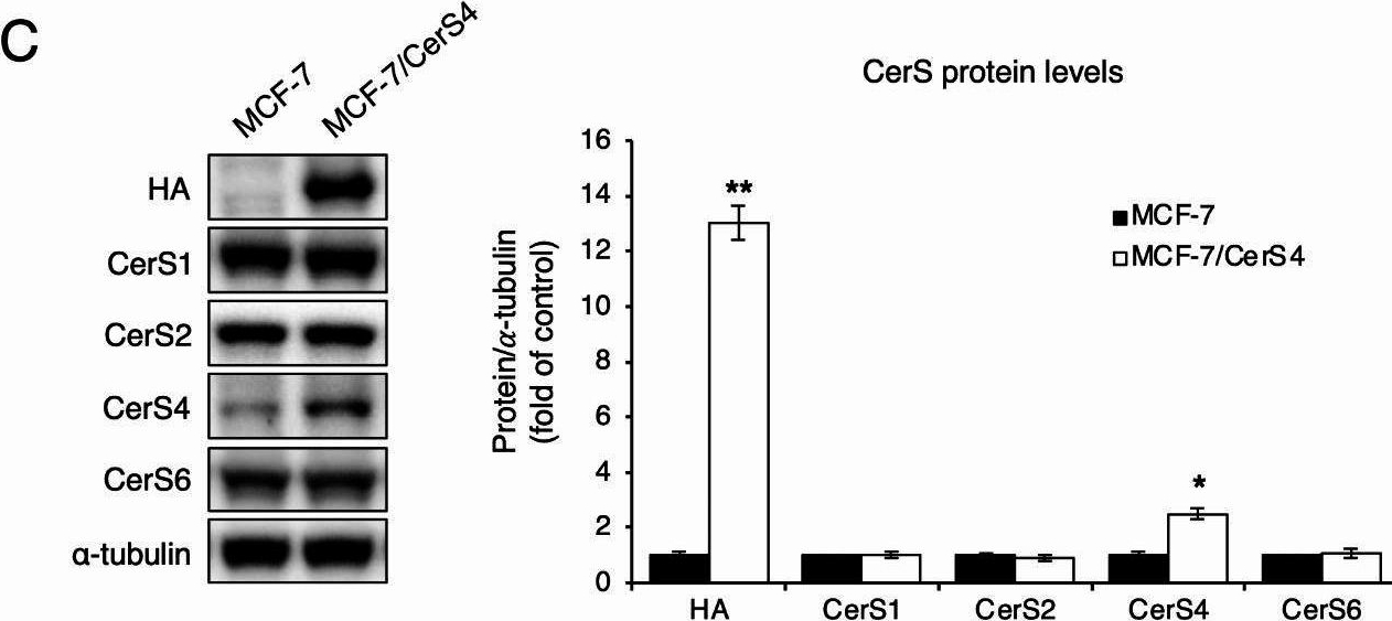 Fig.2.C showing Western Blotting in a Homo sapiens (Human) sample from the publication: Ceramide synthase 4 overexpression exerts oncogenic properties in breast cancer.