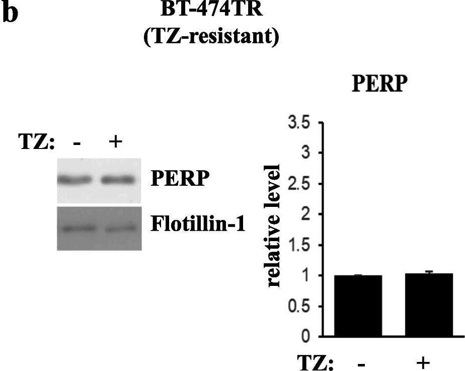 Fig.2.B showing Western Blotting in a Homo sapiens (Human) sample from the publication: Trastuzumab-induced upregulation of a protein set in extracellular vesicles emitted by ErbB2-positive breast cancer cells correlates with their trastuzumab sensitivity.