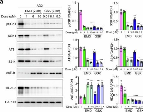 Fig.9.A showing Western Blotting from the publication: Elevated SGK1 increases Tau phosphorylation and microtubule instability in Alzheimer's patient-derived cortical neurons.