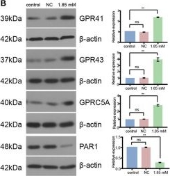 Fig.5.B showing Western Blotting in a Homo sapiens (Human) sample from the publication: Gut microbiome and serum short-chain fatty acids are associated with responses to chemo- or targeted therapies in Chinese patients with lung cancer.