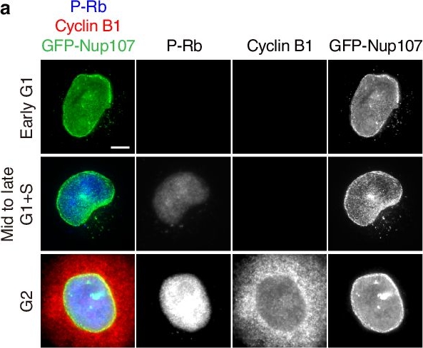 Fig.2.A showing Immunocytochemistry-immunofluorescence in a Homo sapiens (Human) sample from the publication: RanBP2-dependent annulate lamellae drive nuclear pore assembly and nuclear expansion.