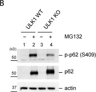 Proteotoxic stress induces phosphorylation of p62/SQSTM1 by ULK1 to regulate selective autophagic clearance of protein aggregates.