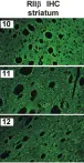 Fig.2.C showing Immunohistochemistry in a Mus musculus (House mouse) sample from the publication: Mutations in AKAP5 disrupt dendritic signaling complexes and lead to electrophysiological and behavioral phenotypes in mice.