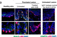 Fig.4.D showing Immunohistochemistry-immunofluorescence from the publication: Down-Regulation of HLA-C Expression on Melanocytes May Contribute to the Therapeutic Efficacy of UVB Phototherapy in Psoriasis.