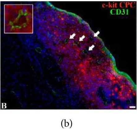 Fig.5.B showing Immunohistochemistry in a Rattus norvegicus (Rat) sample from the publication: C-Kit Cardiac Progenitor Cell Based Cell Sheet Improves Vascularization and Attenuates Cardiac Remodeling following Myocardial Infarction in Rats.
