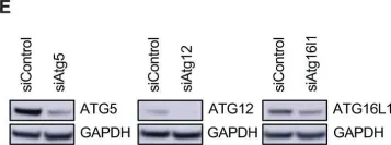 Fig.6.E showing Western Blotting from the publication: A new vulnerability to BET inhibition due to enhanced autophagy in BRCA2 deficient pancreatic cancer.