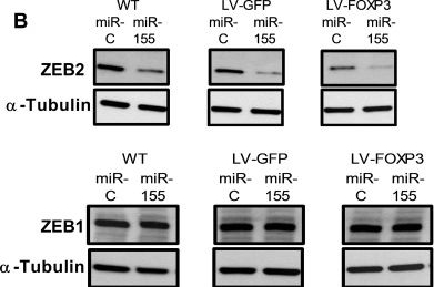 Fig.4.B showing Western Blotting in a Homo sapiens (Human) sample from the publication: FOXP3 and miR-155 cooperate to control the invasive potential of human breast cancer cells by down regulating ZEB2 independently of ZEB1.